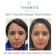 skin transformation.jpeg